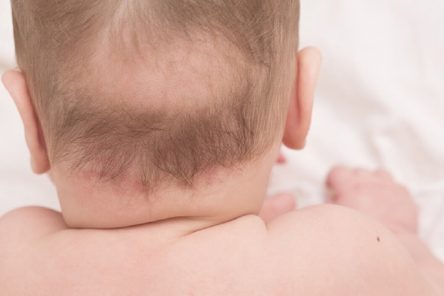Khám phá từ A đến Z về tình trạng trẻ bị rụng tóc