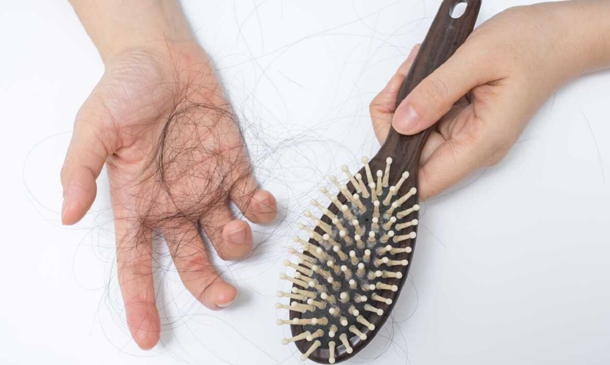 Bị rụng tóc thiếu chất gì? Nên bổ sung gì cho tóc khỏe mạnh?